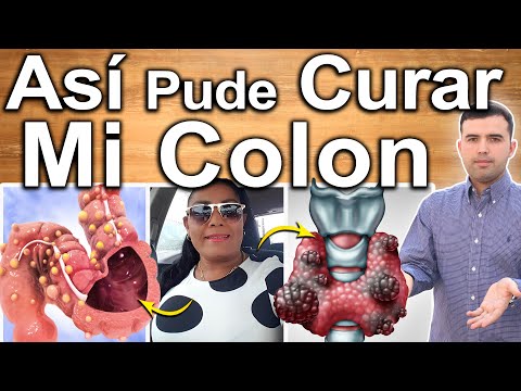 Famosos que padecen la enfermedad de Crohn: conoce sus testimonios.