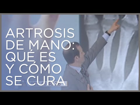 Alivio instantáneo: Los mejores guantes para combatir la artrosis de manos