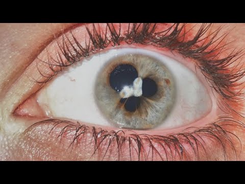 La evolución de los ojos de buey: modernidad y sofisticación en tu hogar