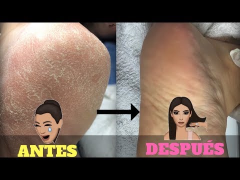 Las mejores limas para eliminar las durezas de tus pies